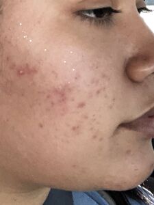 Liltriste Bbytriste Hot photos Tristeluna Tristebby XXX